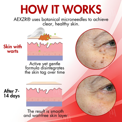 🏆AEXZR® Nano-Microdart Skin Tag & Spot Corrector Patches