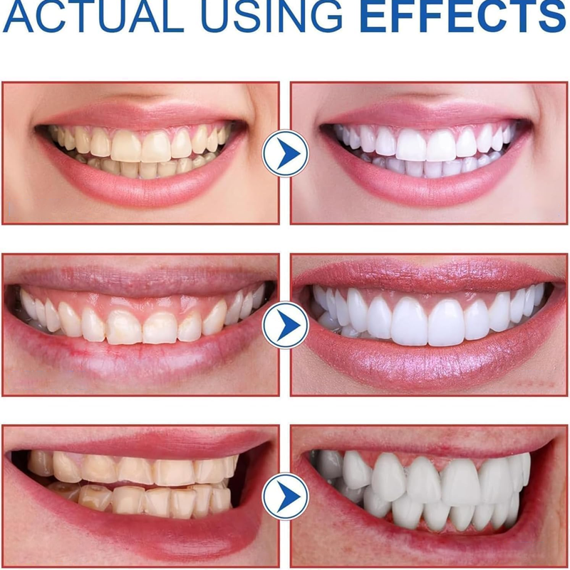✨🦷OUTDR™SP-8 Probiotic Whitening Toothpaste🦷🍃