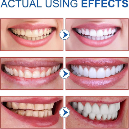 ✨🦷OUTDR™SP-8 Probiotic Whitening Toothpaste🦷🍃