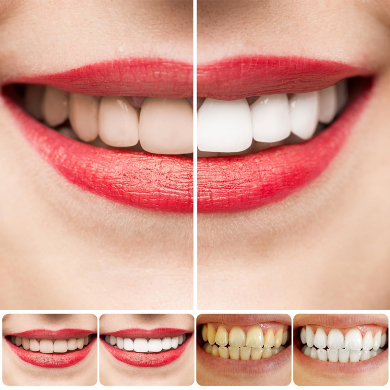 ✨🦷OUTDR™SP-8 Probiotic Whitening Toothpaste🦷🍃