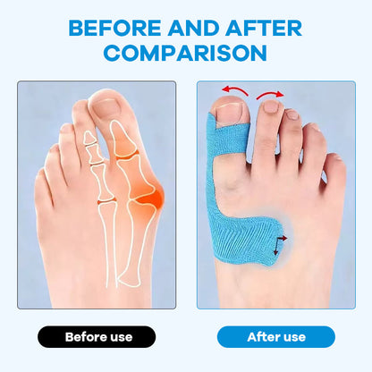 🏆Medical-Grade Bunion Tape – 🦶Hypoallergenic, Breathable, Painless Removal👟