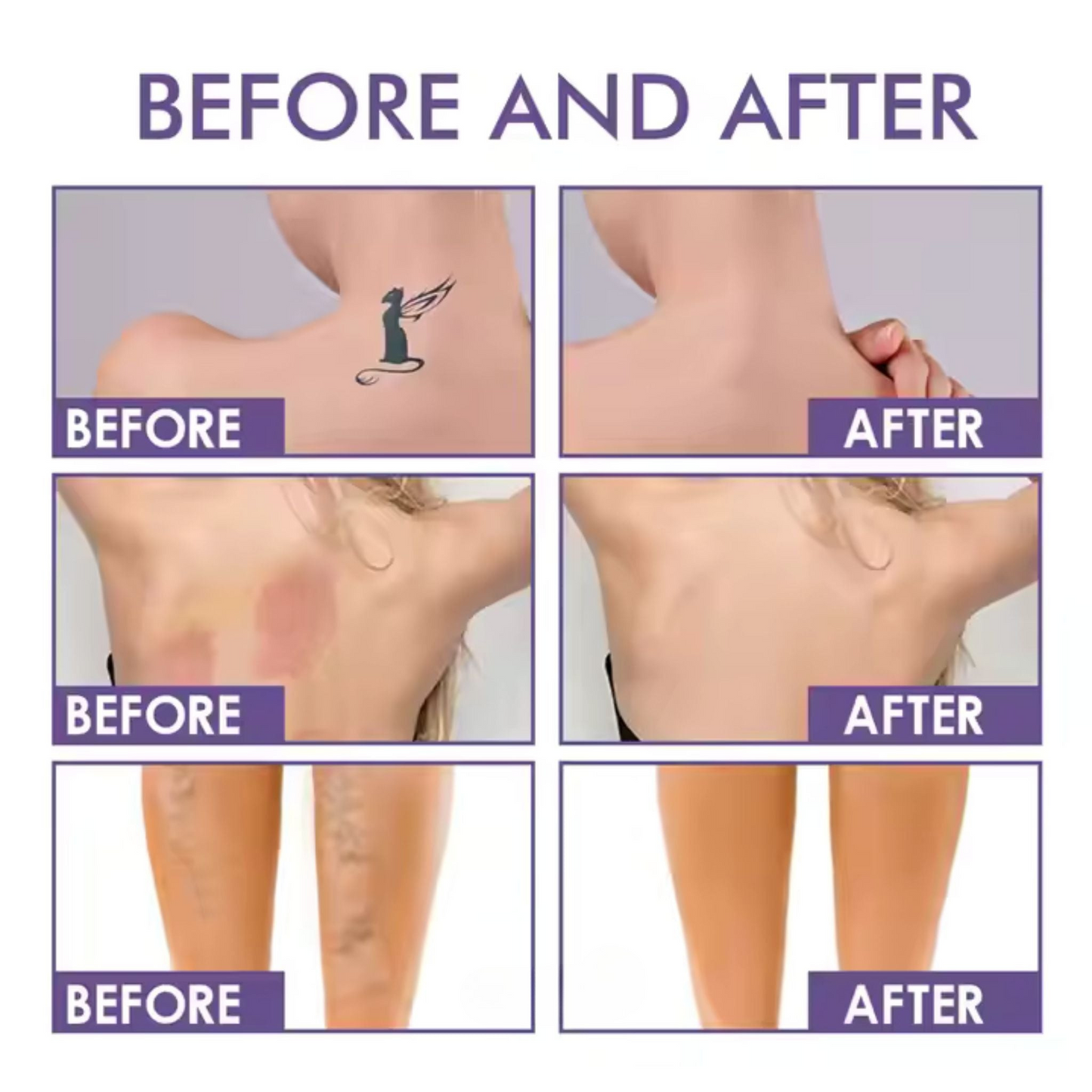 ✨ Body Coverage Perfector Cream – 🌿Instantly Conceals Spider Veins & Scars, Natural Finish✨