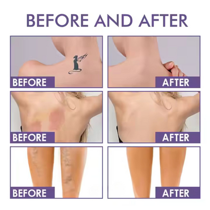 ✨ Body Coverage Perfector Cream – 🌿Instantly Conceals Spider Veins & Scars, Natural Finish✨